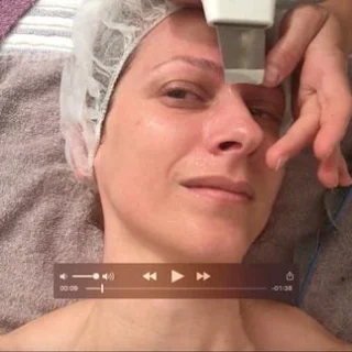 VIDEO: odgovori na dileme v zvezi z IPL odstranjevanjem dlak