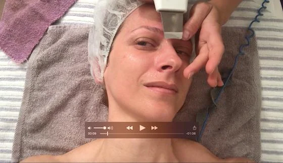 VIDEO: Čiščenje por z ultrazvokom