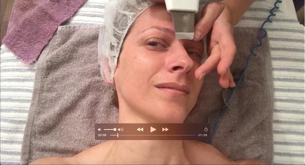 VIDEO: Čiščenje por z ultrazvokom