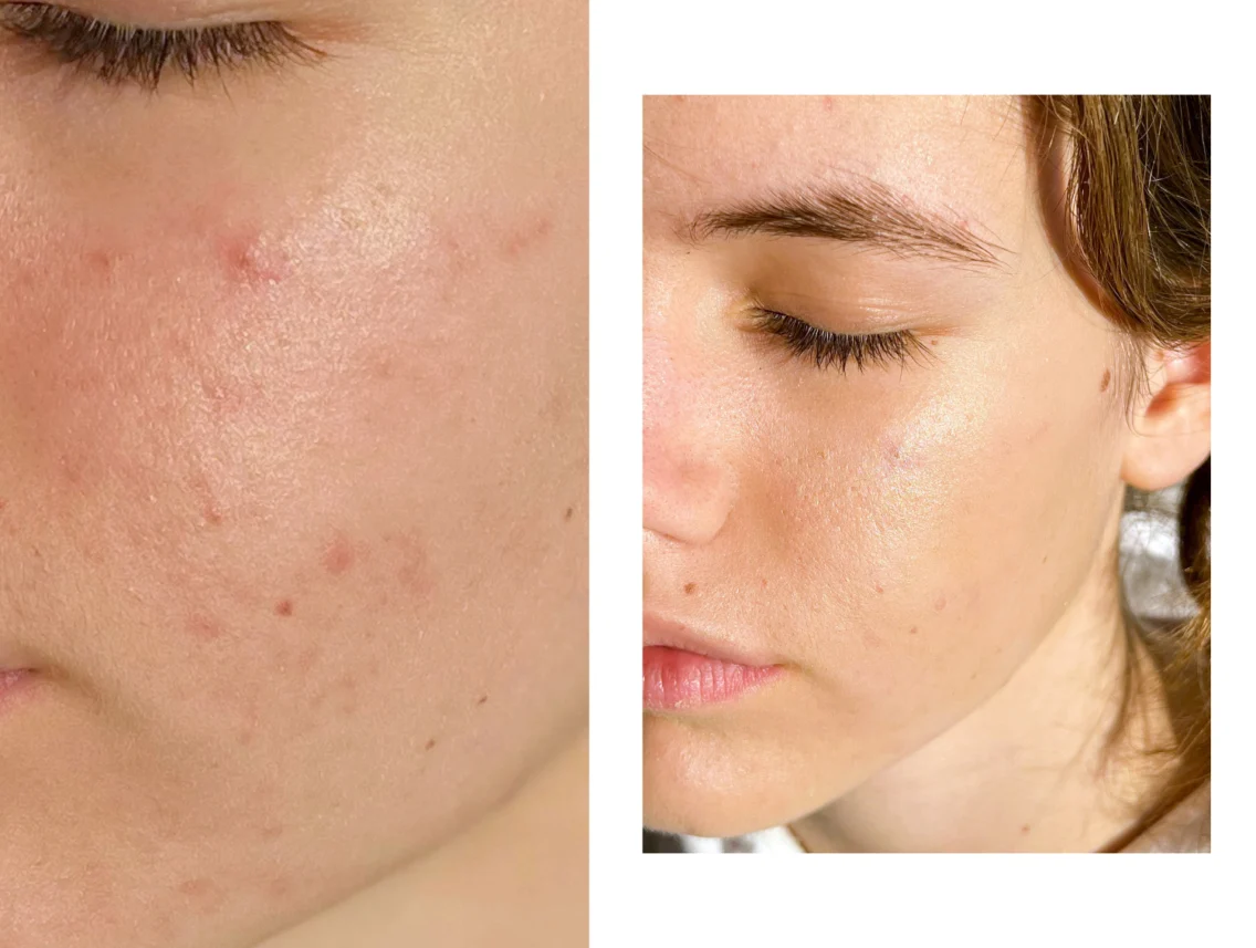 Korektor: vse kar moraš vedeti o tem drugem najbolj prodajanem ličilu