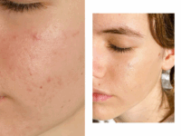 korektor prej potem najboljši rezultat