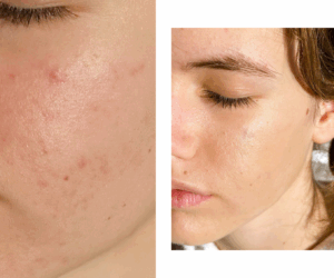 korektor prej potem najboljši rezultat