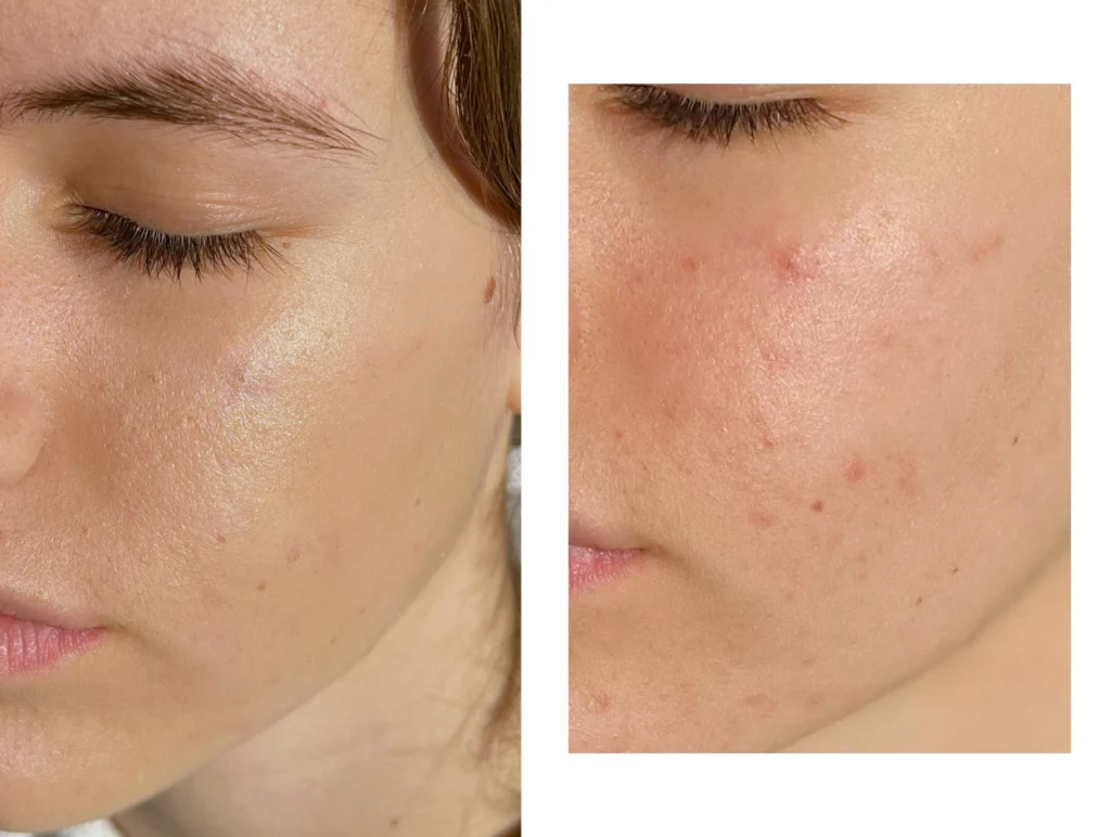 erborian-cc-red-c-orrect-korektor-za-akne-mozolje-rdecice-kuperoza-beautyfullblog