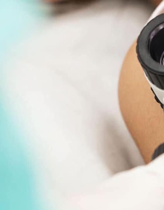 Osebna izkušnja: dermatološki pregled in odstranjevanje znamenj