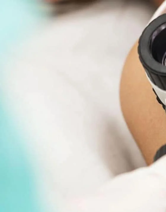 Osebna izkušnja: dermatološki pregled in odstranjevanje znamenj