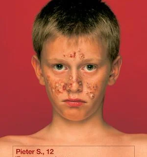 OCENA: Philips VisaPure